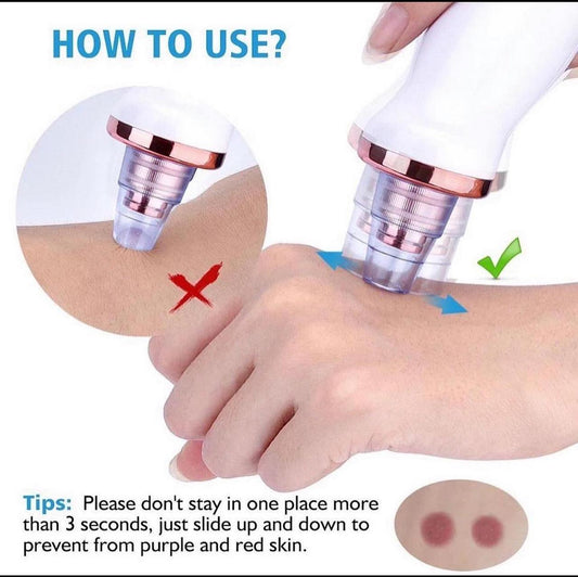 Blackhead Suction Machine
